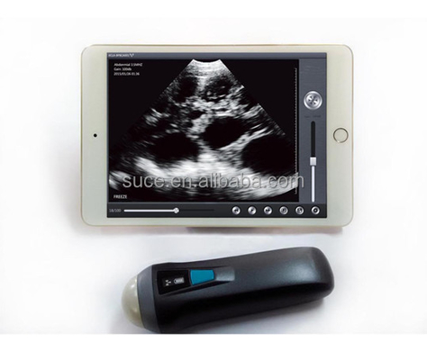 Laptop color Doppler ultrasound system Uprobe-1