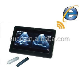 Laptop color Doppler ultrasound system Uprobe-1