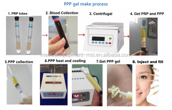 Autologous Collagen Filler Plasma Gel Maker to keep skin elasticity