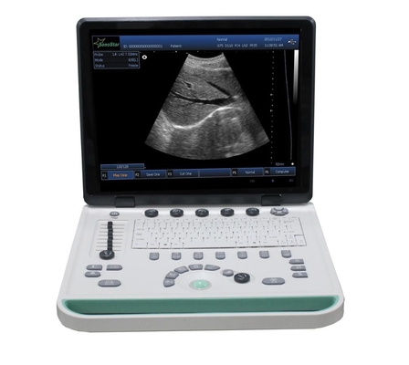 PC based 3D Ultrasound Machine SS-9 Laptop Ultrasound scanner